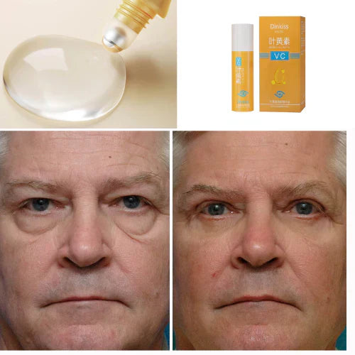 Rolon 5 em 1 Ultra Rejuvenescedor Luteína Inova® PAGUE 1 LEVE 4 (ENVIO NACIONAL)